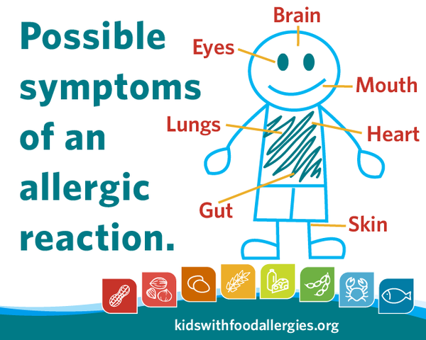 allergic-reaction-symptoms