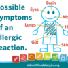 allergic-reaction-symptoms